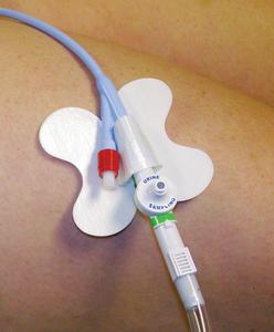 EA/1 CATH-SECURE MULTI-PURPOSE TUBE HOLDER 2 1/2IN WRAP TAB, BUTTERFLY BASE - Save On Medical