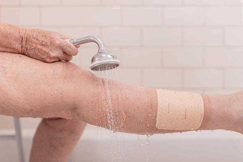 BX/10 MEPILEX BORDER FLEX LITE ADHERENT FOAM DRESSING 4CM X 5CM - Save On Medical