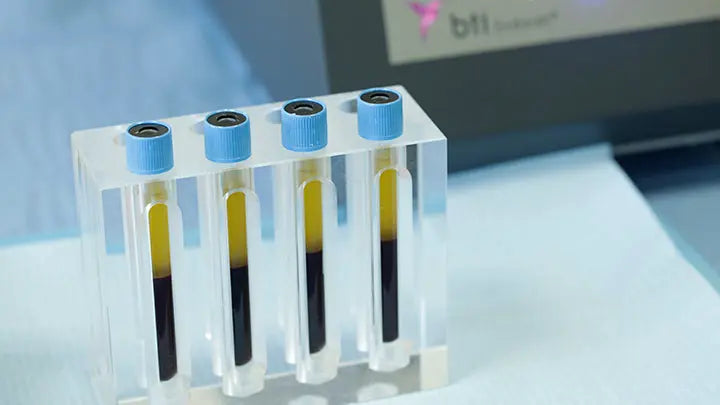 PRGF – ENDORET® - Save On Medical