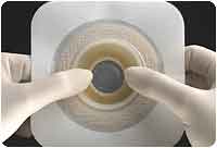 BX/10 NATURA MOLDABLE DURAHESIVE, FLANGE 2 3/4IN (70MM), CUT-TO-FIT 1-5/16IN (33MM) - 1 3/4IN (45MM) - Save On Medical