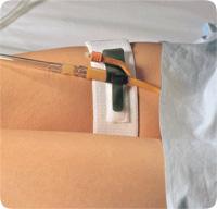 EA/1 FOLEY CATH HOLDER, LEG BAND  2IN X 19.5IN - Save On Medical
