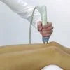 BTL-6000 EASY Radial Shockwave